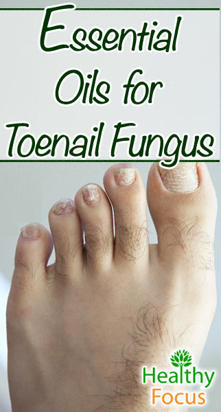 9 Science Backed Essential Oils for Toenail Fungus - Healthy Focus