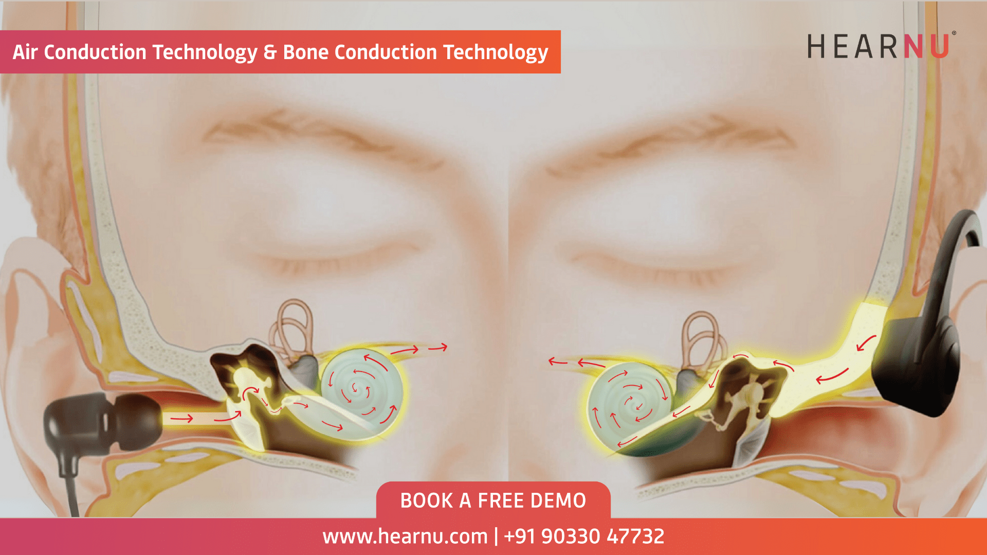 Amazing Bone Conduction Audio While Eating: The Proven Way to Enhance Your Dining Experience 6 air conduction vs bone conduction comparison