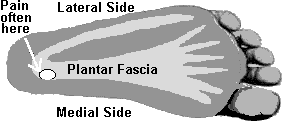 Posterior Calcaneal Spur