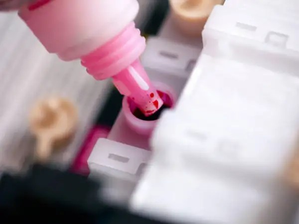 Are Refill Ink Cartridges Worth Choosing?