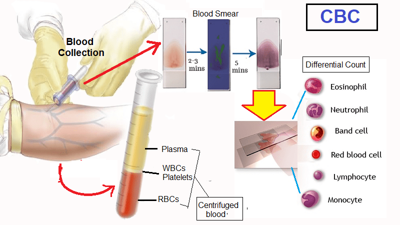 Complete blood count - CBC Normal Values - Helal Medical