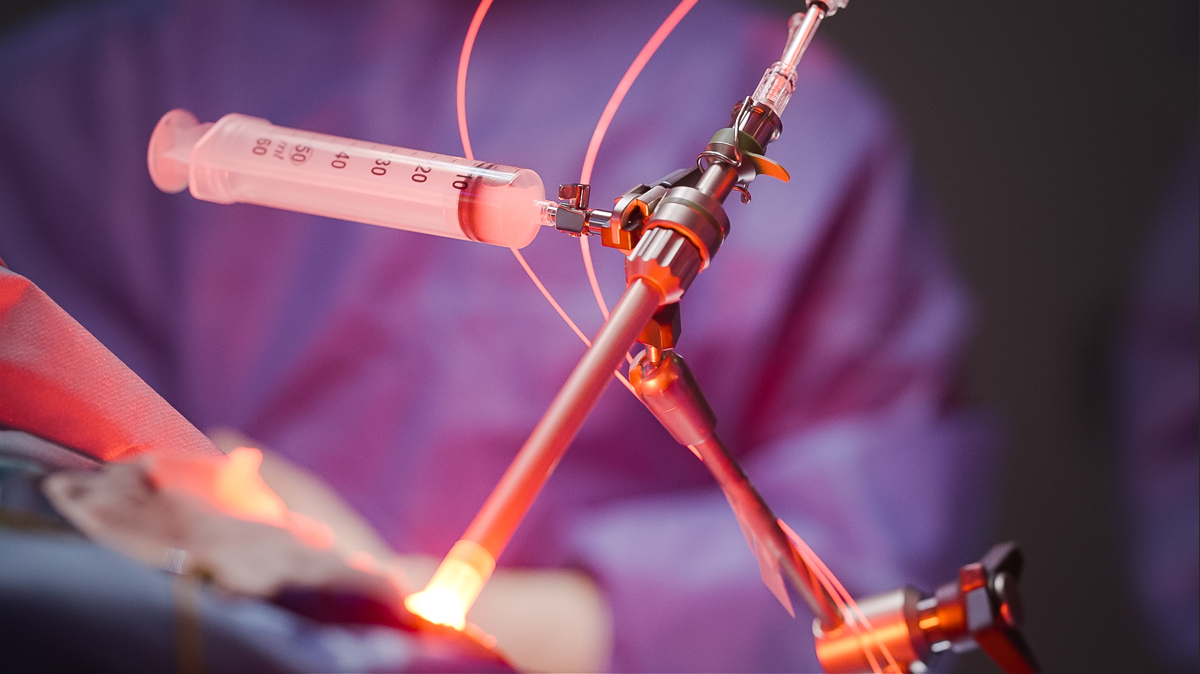 Application of the applicator