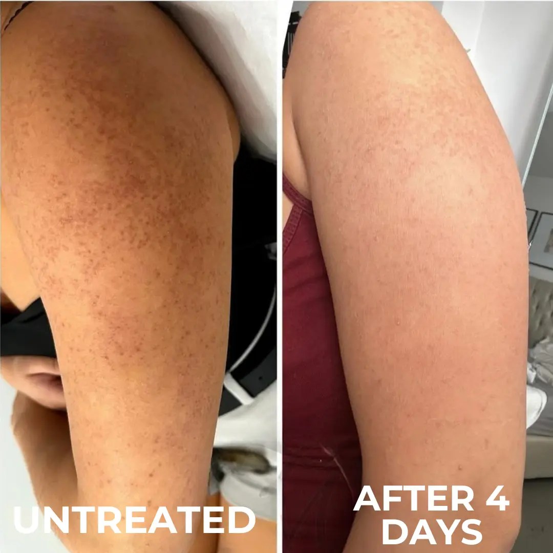 Diane M. before and after