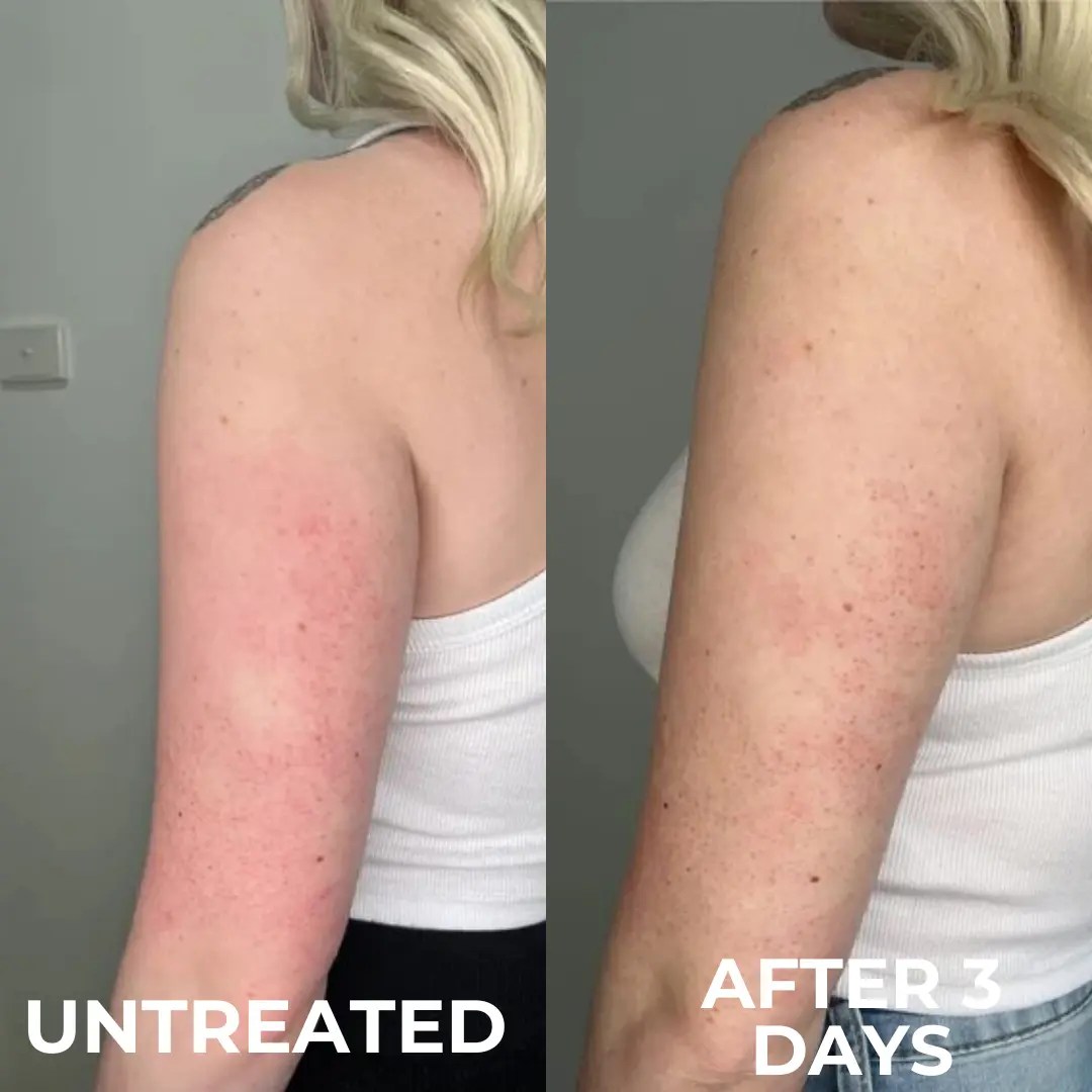 Michelle R. before and after