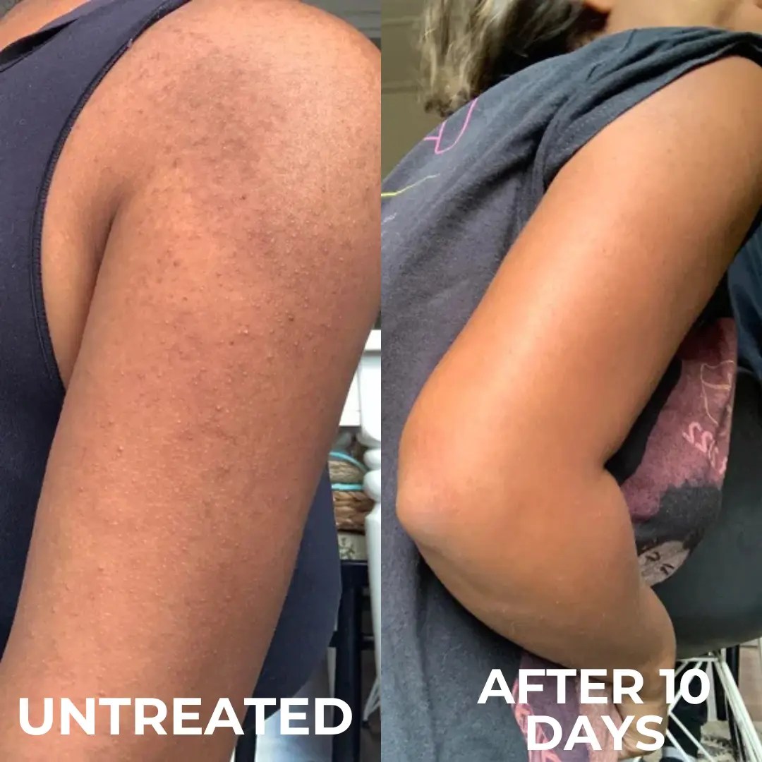 Samantha K. before and after