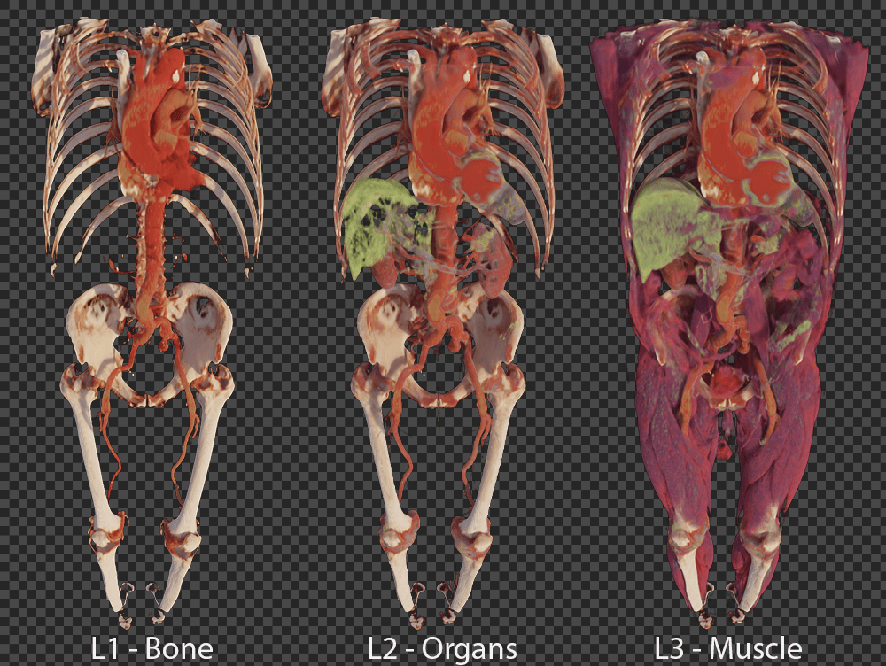 Multi-layer gaussian splatting for immersive anatomy visualization
