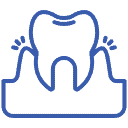 gingivitis