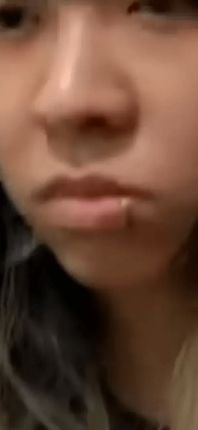 女版Tyson Yoshi