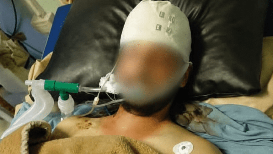 توفي الشاب محمد غميرة جراء تعرضه للضرب في مخفر مدينة الحفة بريف اللاذقية ومضاعفات مرض الناعور المصاب به