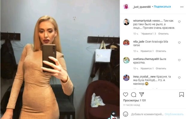 Украинка с самыми большими скулами в мире показала себя до инъекций. Фото