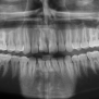 SerdarHelli/Segmentation-of-Teeth-in-Panoramic-X-ray-Image-Using-U-Net ...