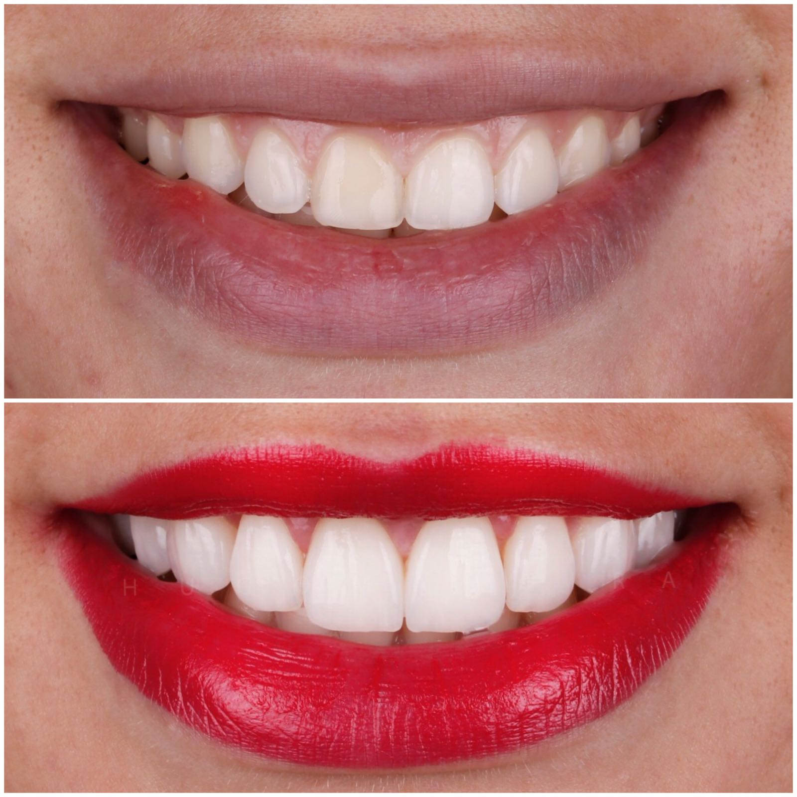 Não se esqueçam de subscrever o canal e de activar as notificações :) a vossa opinião é muito importante para mim. Test Hugo Madeira