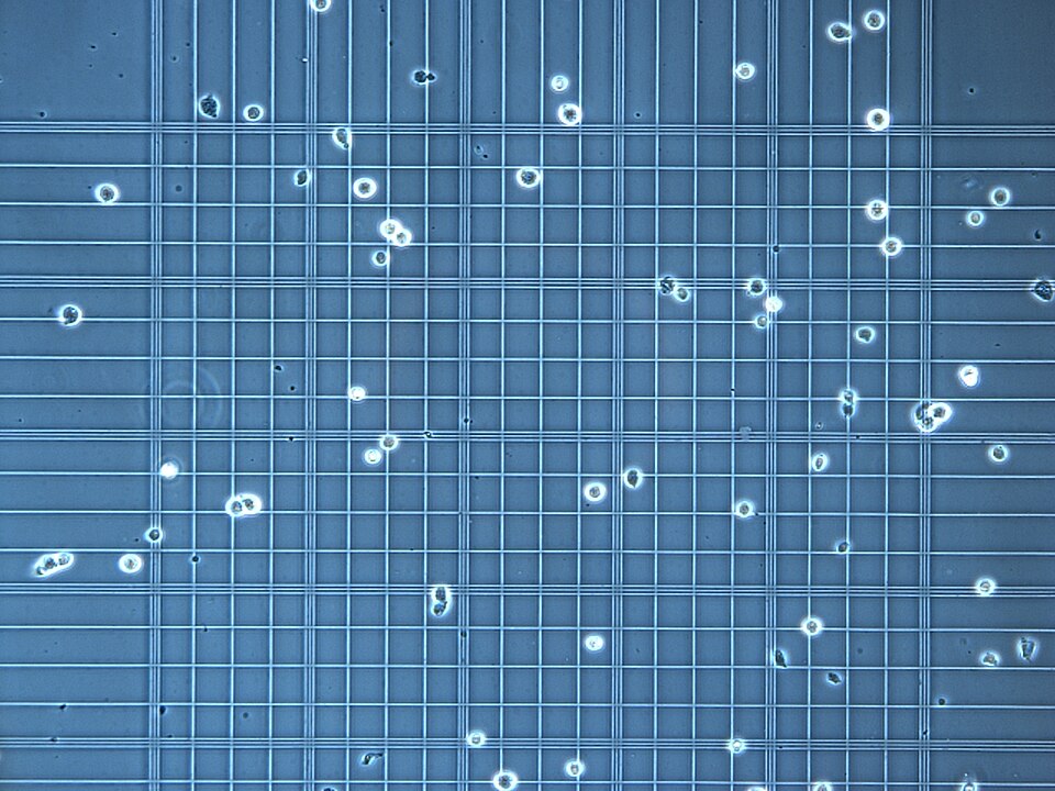 Microscope view of cultured cells positioned over the grid of a Neubauer counting chamber