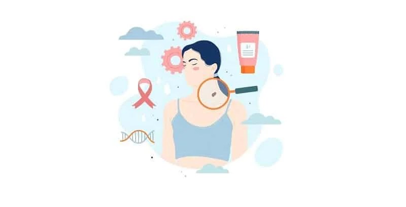 skin cancer