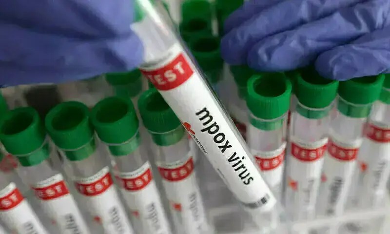 Mpox Outbreak in Pakistan: What You Need to Know | Khairpur Cases Explained (2026)