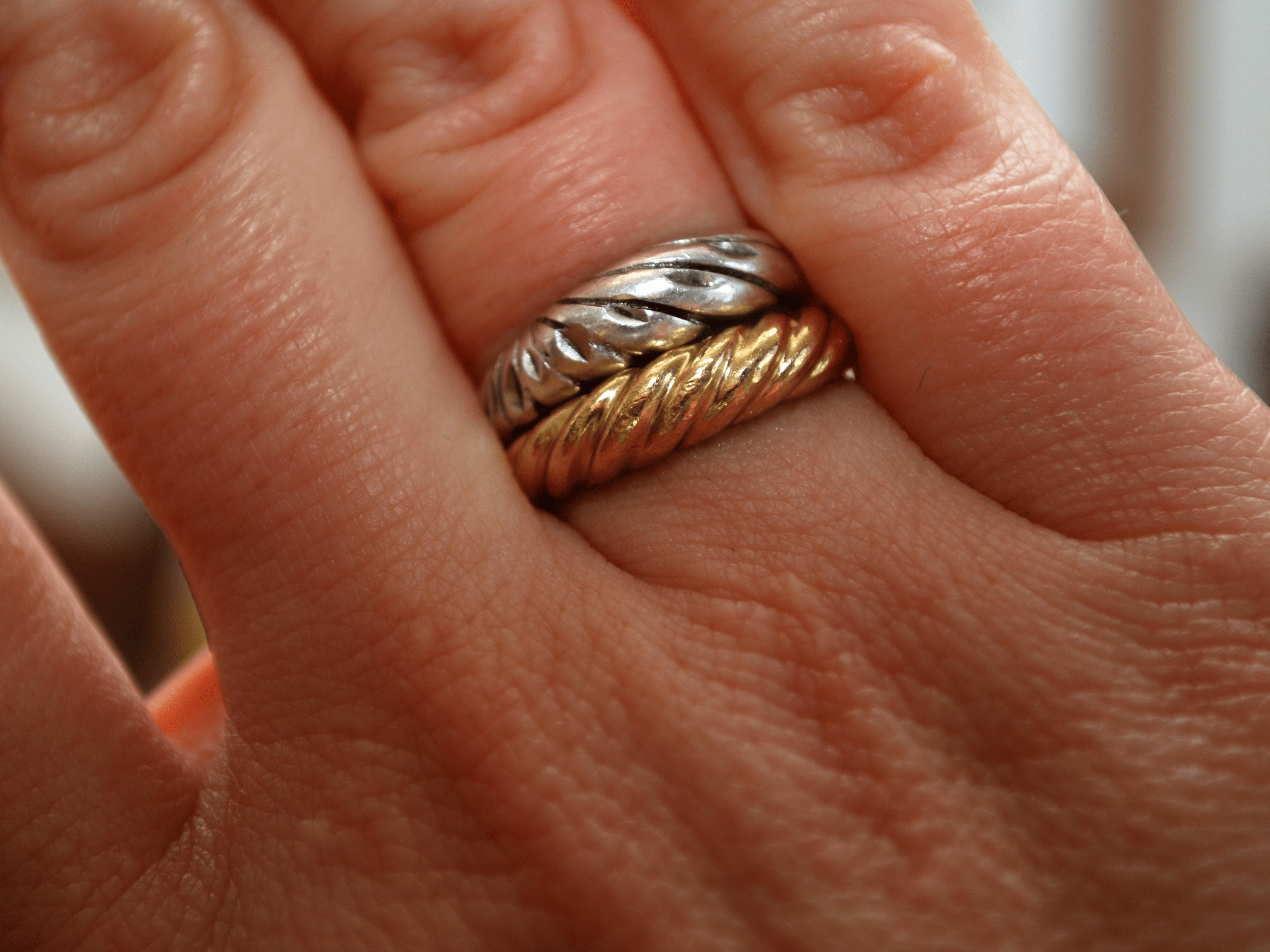 heres how to prevent your skin from turning green from jewelry on why does my wedding ring turn my finger green