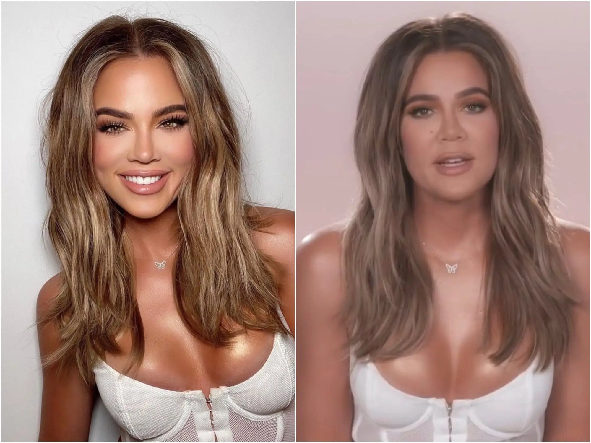 But apparently that's not all. Khloe Kardashian S Face Alterations Plastic Surgeons Explain