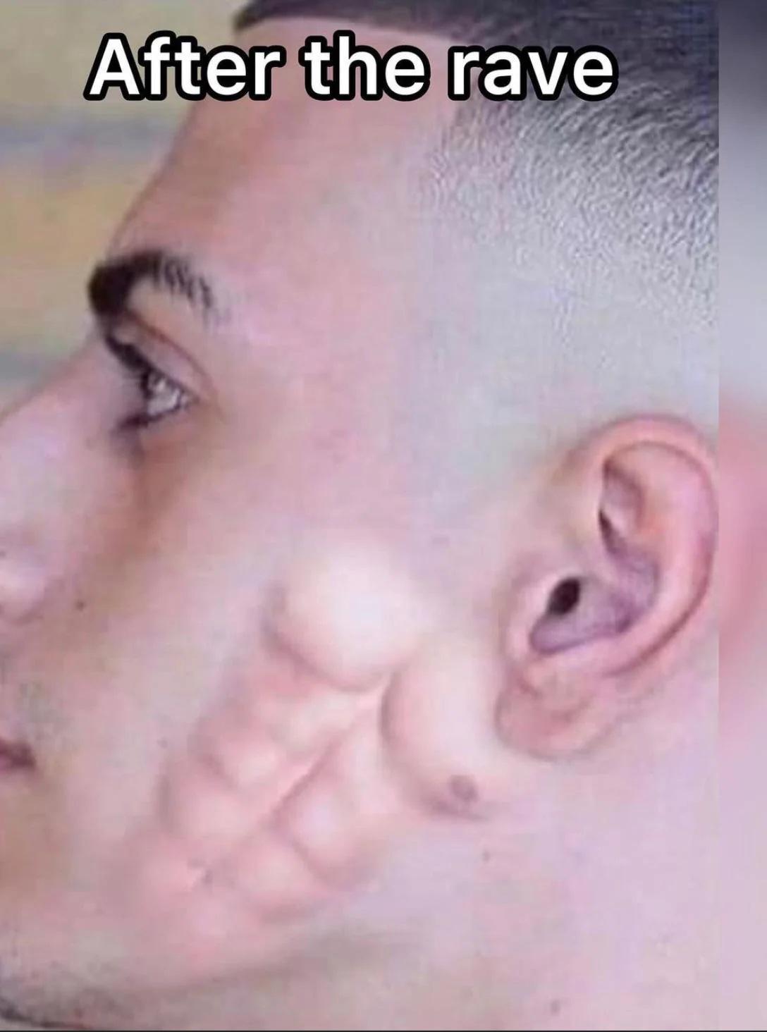 Petah why does his cheek look hot now? : rPeterExplainsTheJoke