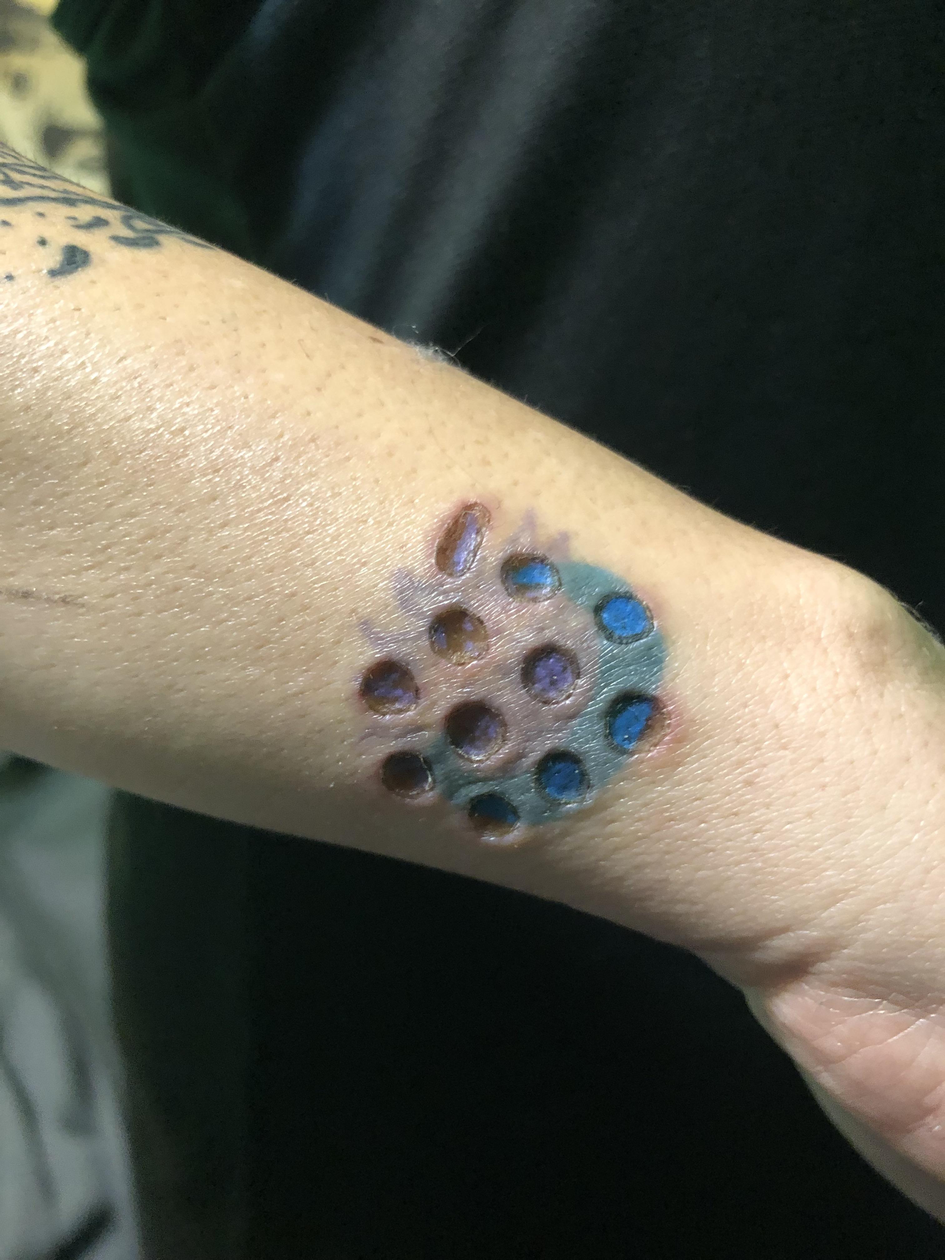 Create your free account and we will send you an introductory guide to clickbank. Tattoo removal : trypophobia
