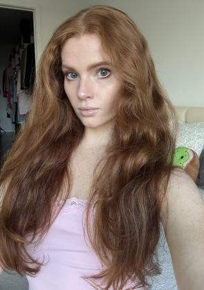 Freckles are my best assets
