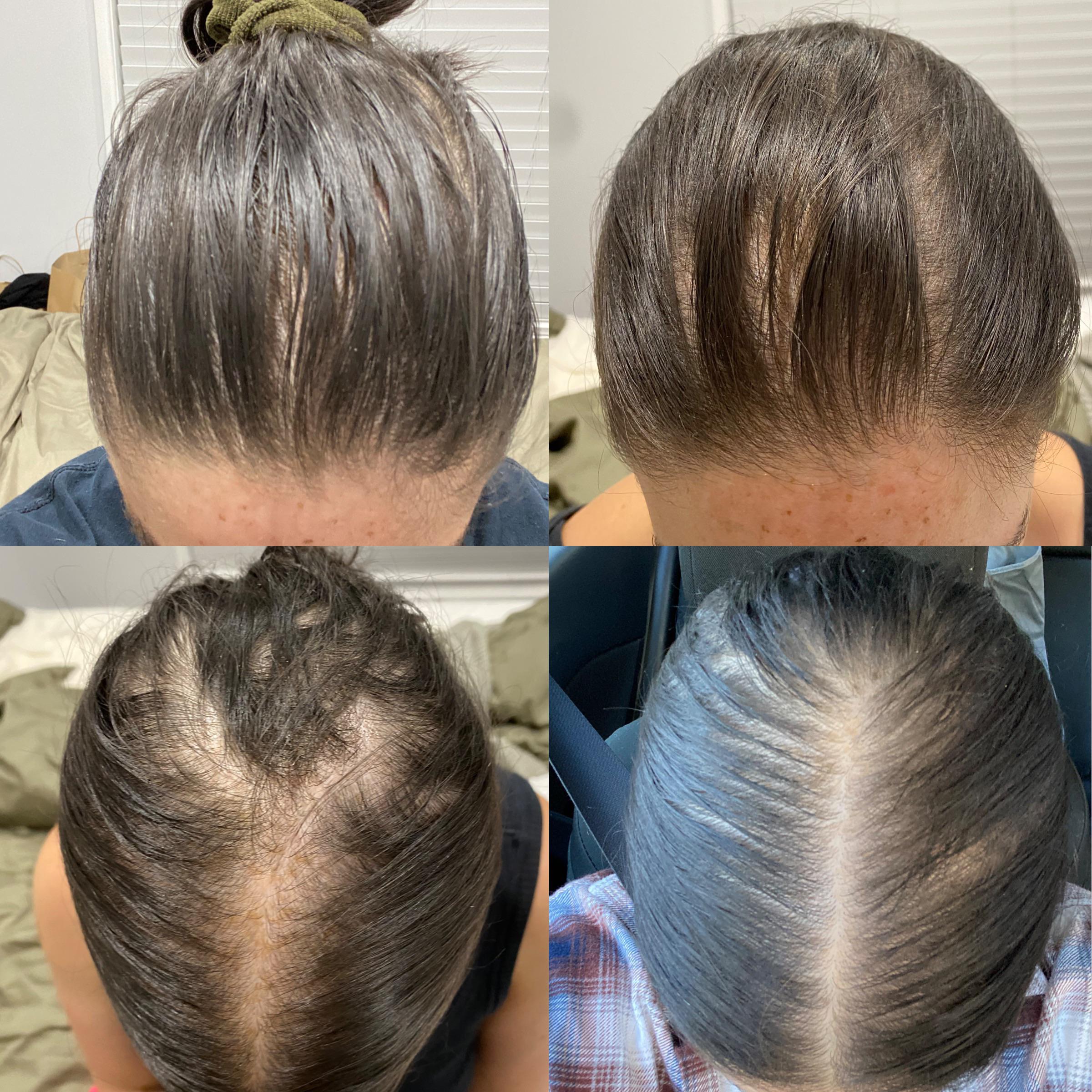 381 best spiro images on pholder