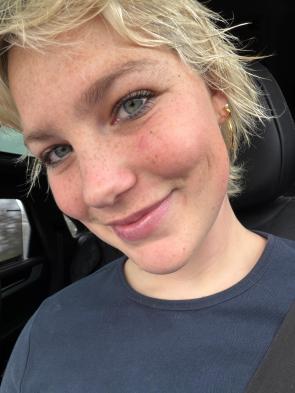 starting to love my freckles