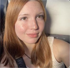 18f my ginger face in natural light