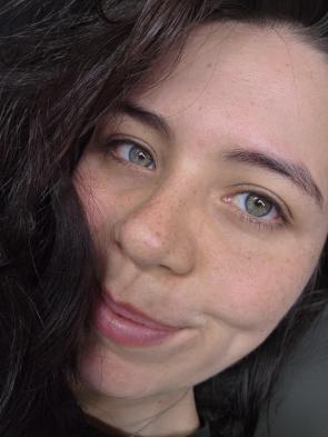 My freckles look darker today.