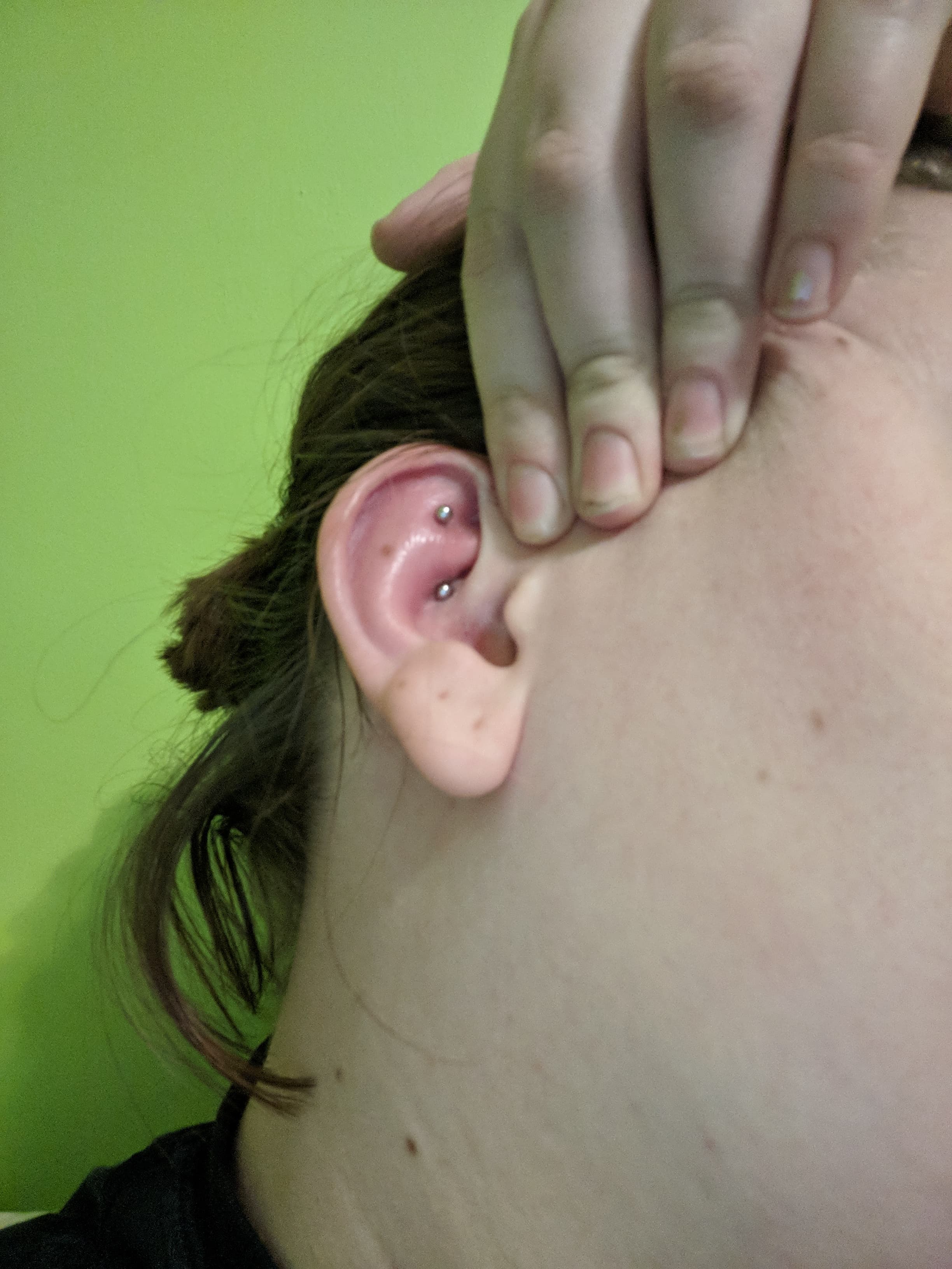 Swollen Rook Worries Done At Whatever Tattoo Nyc By Tino Piercing