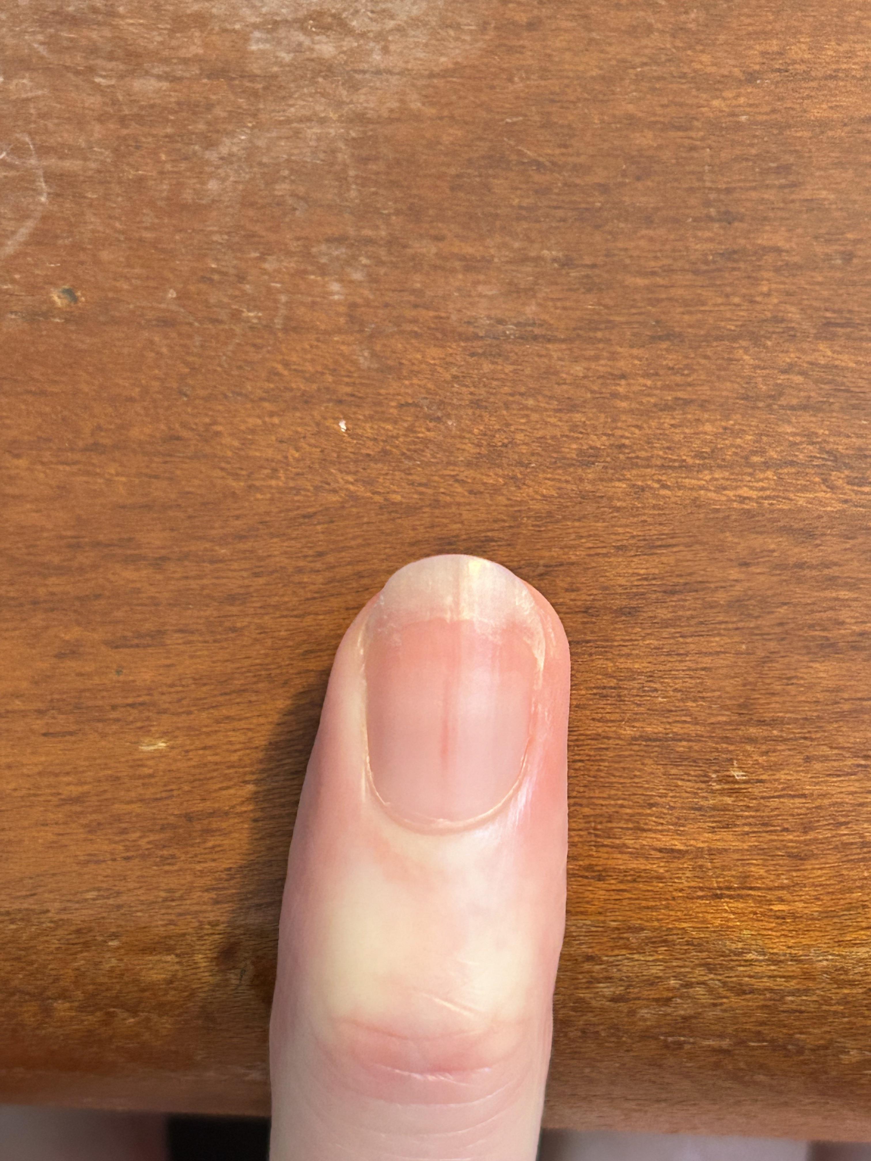 Is this line in my nail concerning?