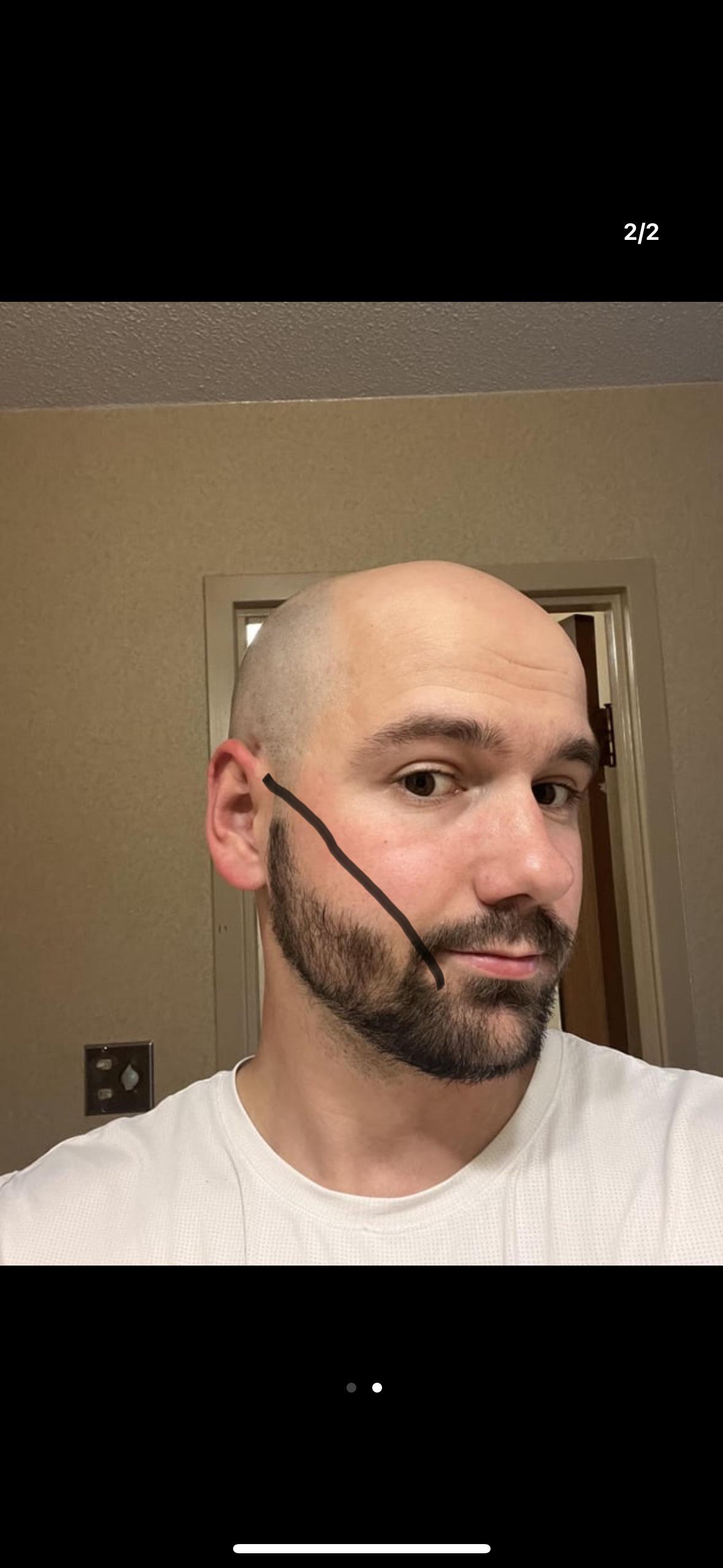 Che ci fate voi pelati barbuti con le basette? Non so che farmene delle mie  : rbald