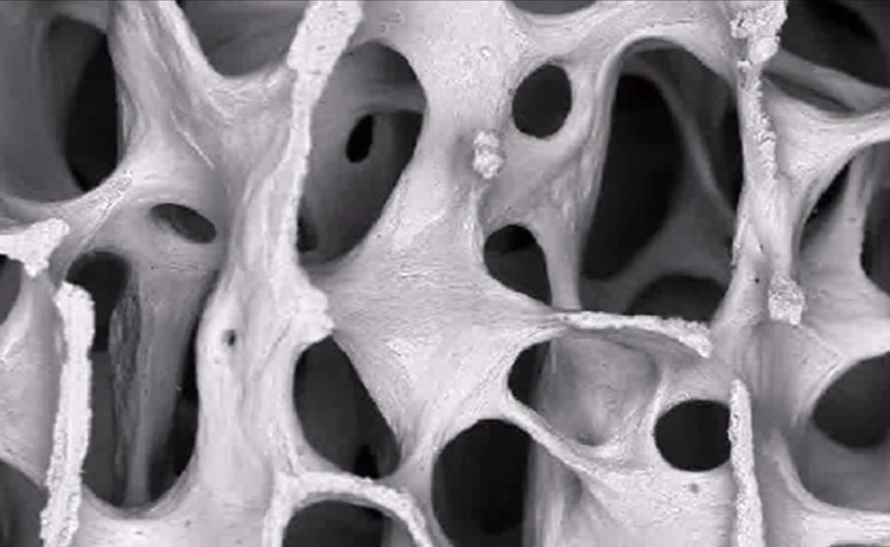 We did not find results for: Human Bones Under Electron Microscope Interestingasfuck