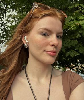 My freckles are my best asset