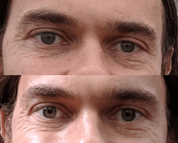 skincareaddiction anti aging