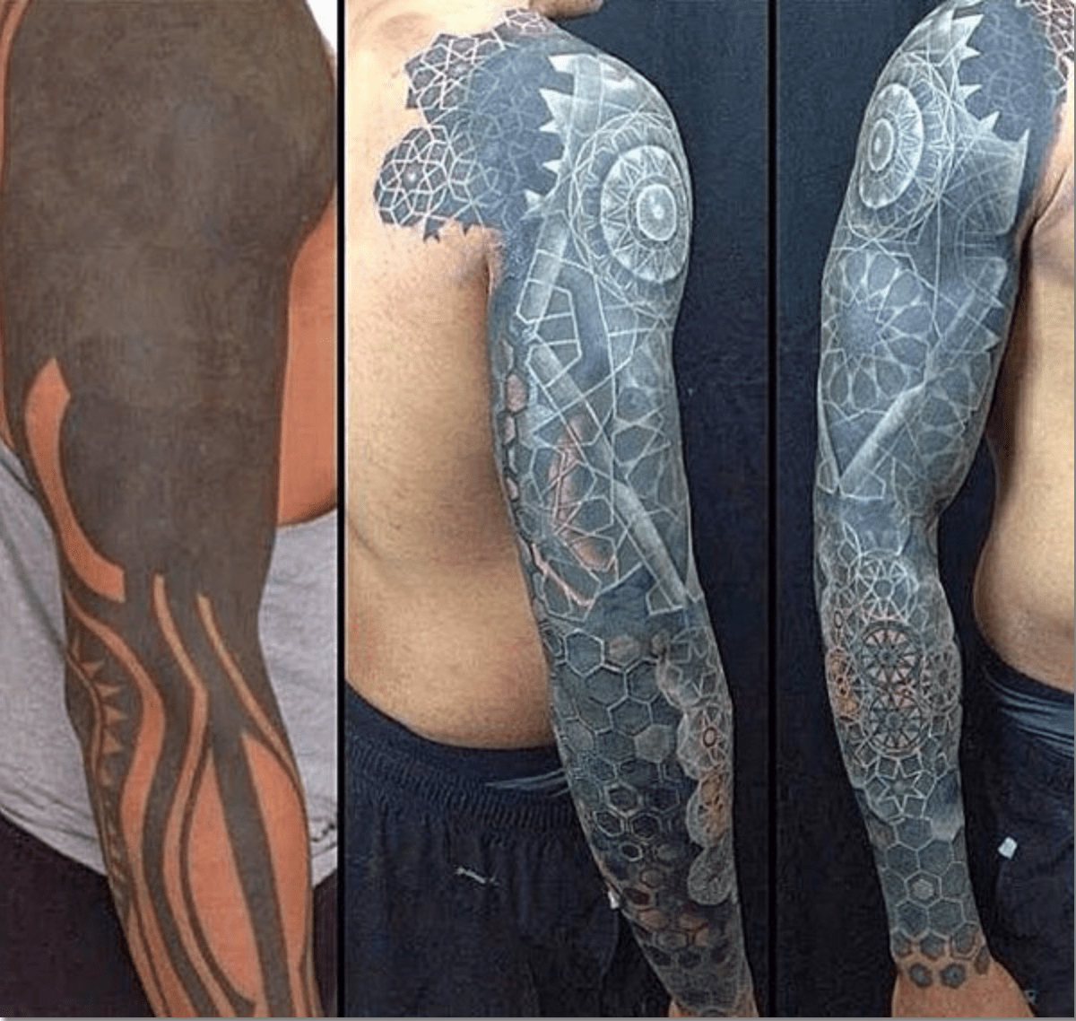 Blackout Tattoo Cover Up Trypophobia Anyone Fixedtattoos