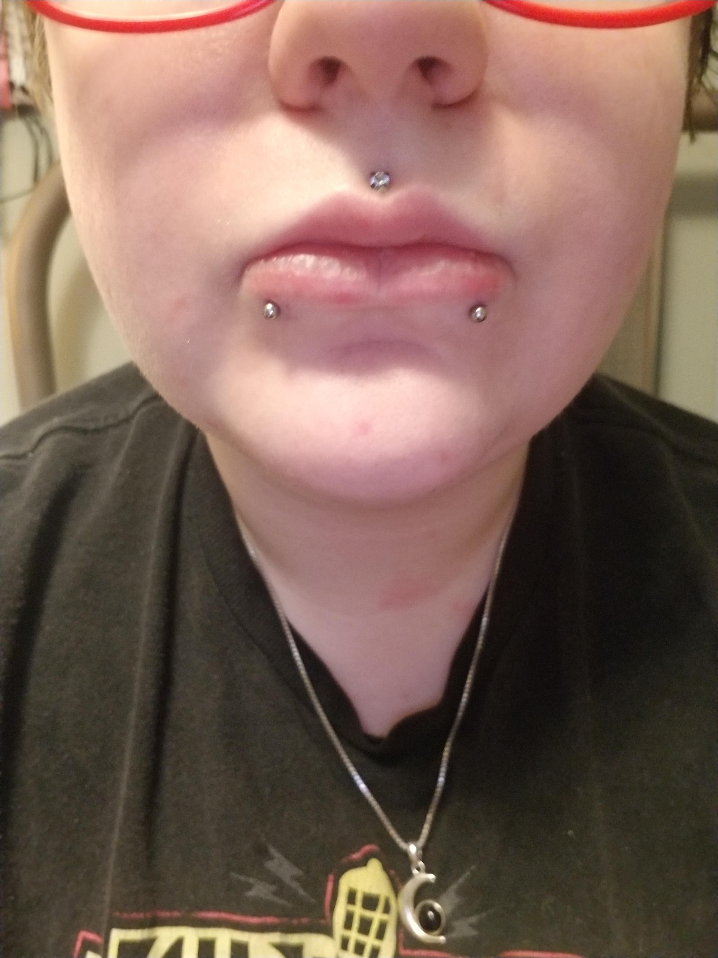snake bite piercings are a type of labret piercing that requires both sides of the bottom lip to be pierced, giving the effect that you've been bitten by a snake. Triange Medusa And Snake Bites Piercing