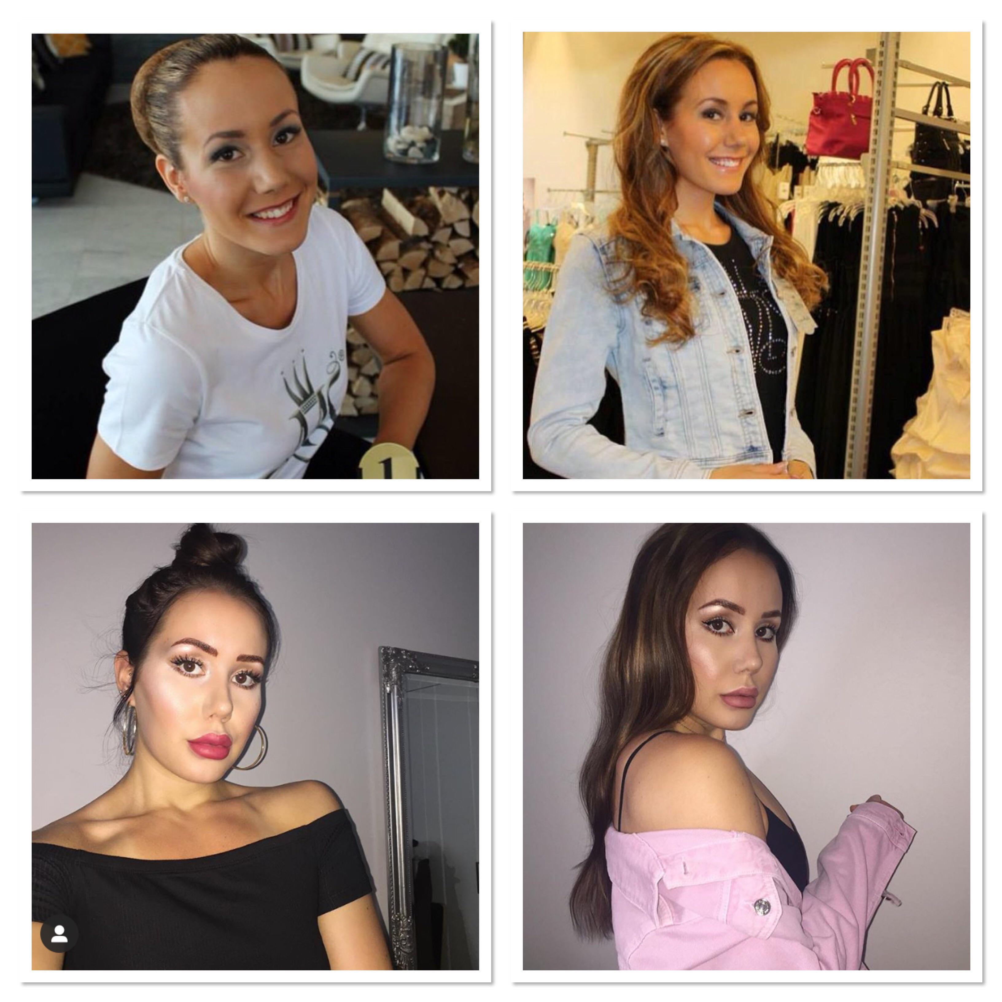 90 day fiance plastic surgery