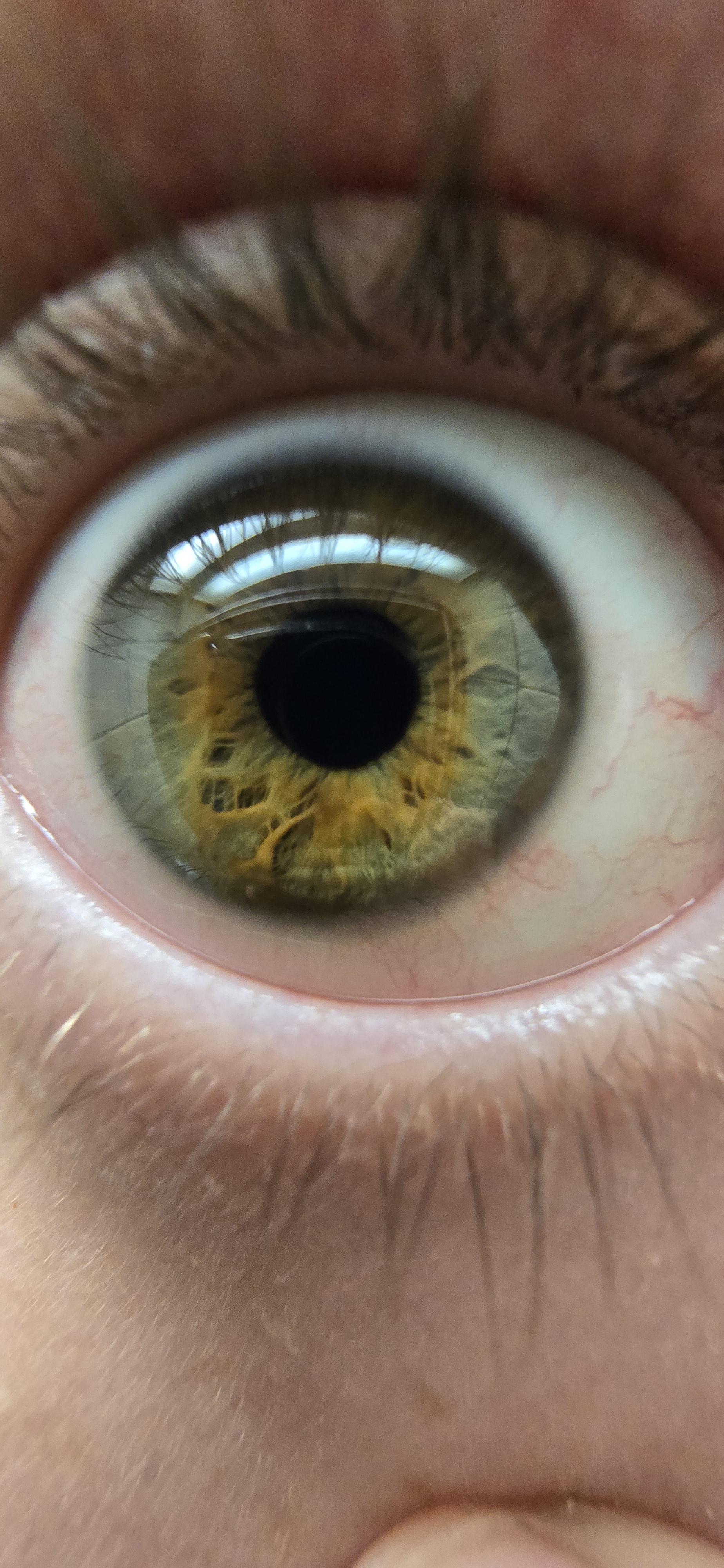 Ive always just thought my eyes were brown but my girlfriend says they  look green? : rWhatisMyEyeColour