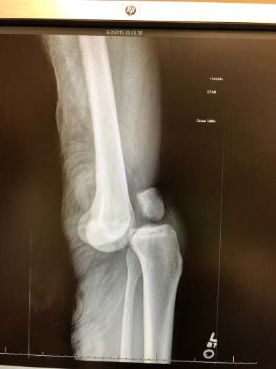 sjis Image