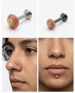This pimple piercing