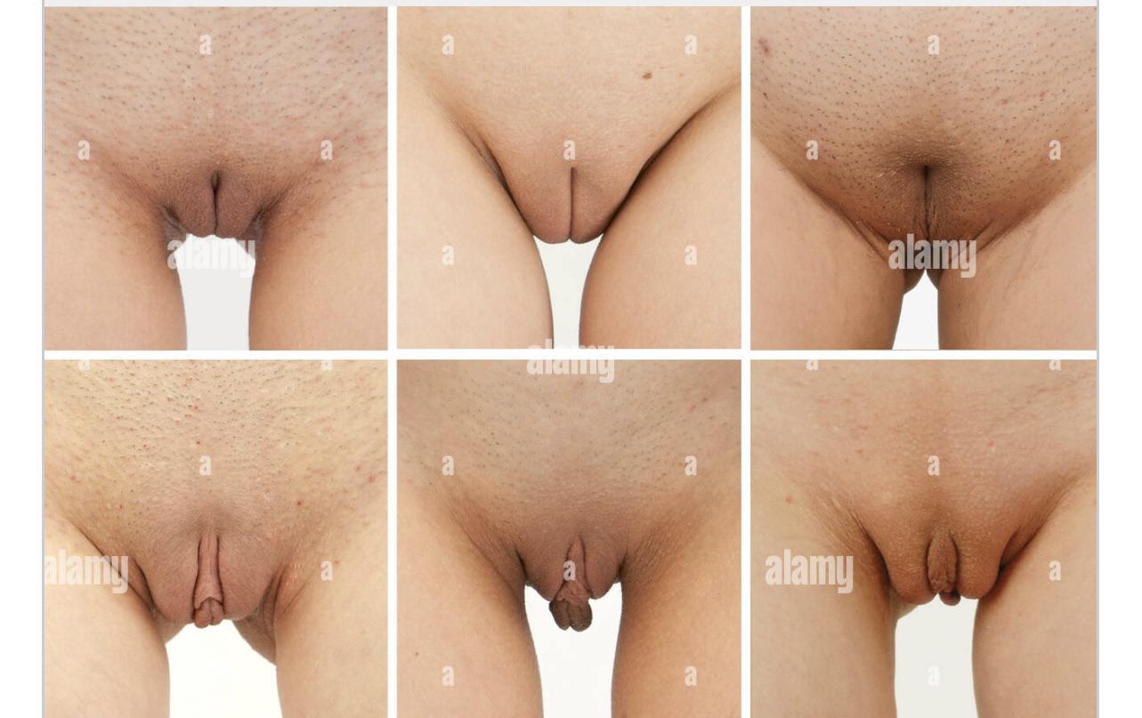 What vagina shape is the most attractive? : rLabiaplastySurgery
