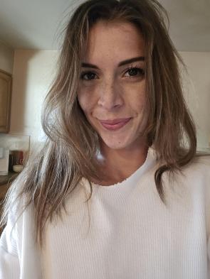 Face full of freckles