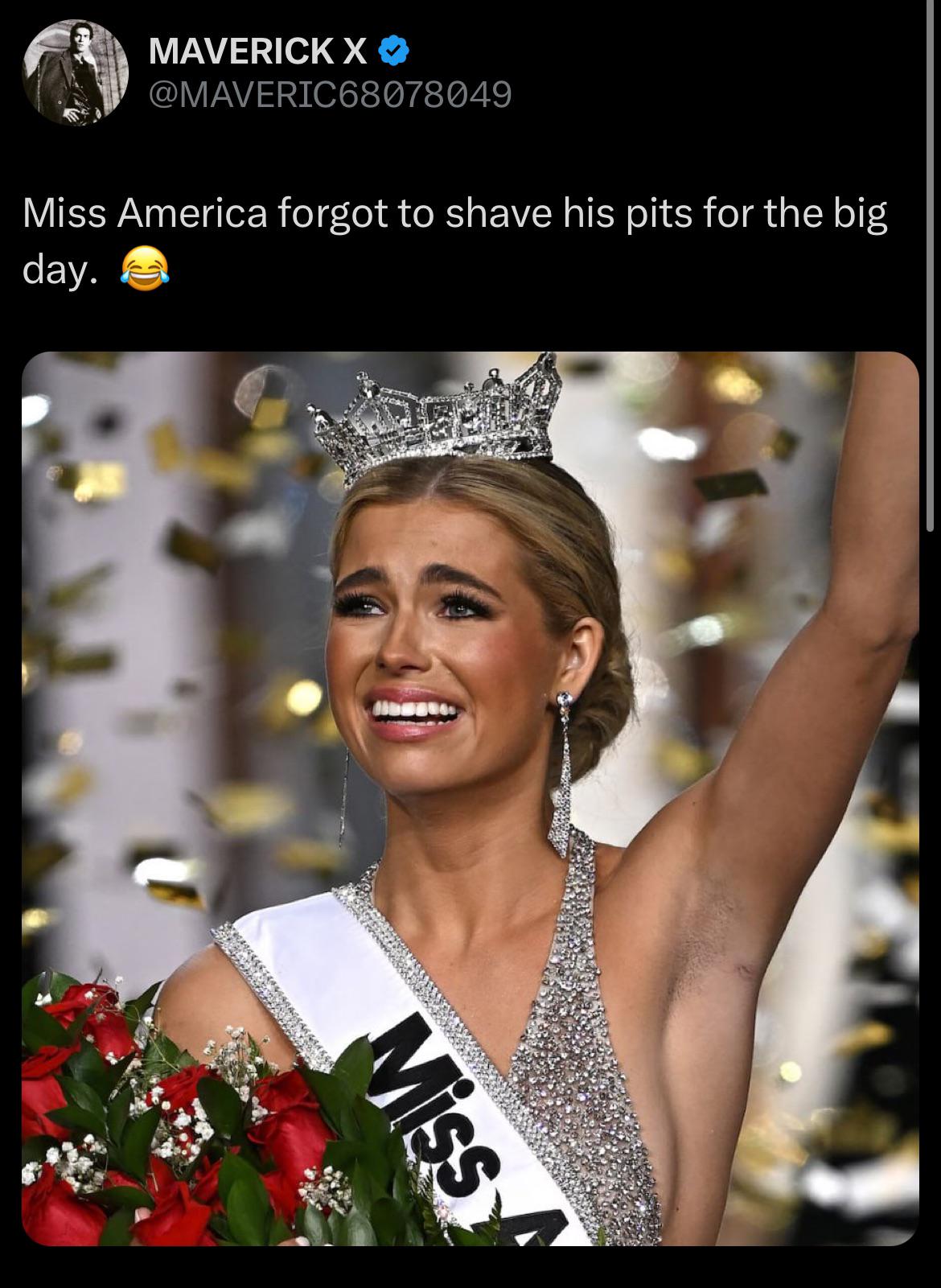 of course, because only men are allowed to not shave : rpointlesslygendered