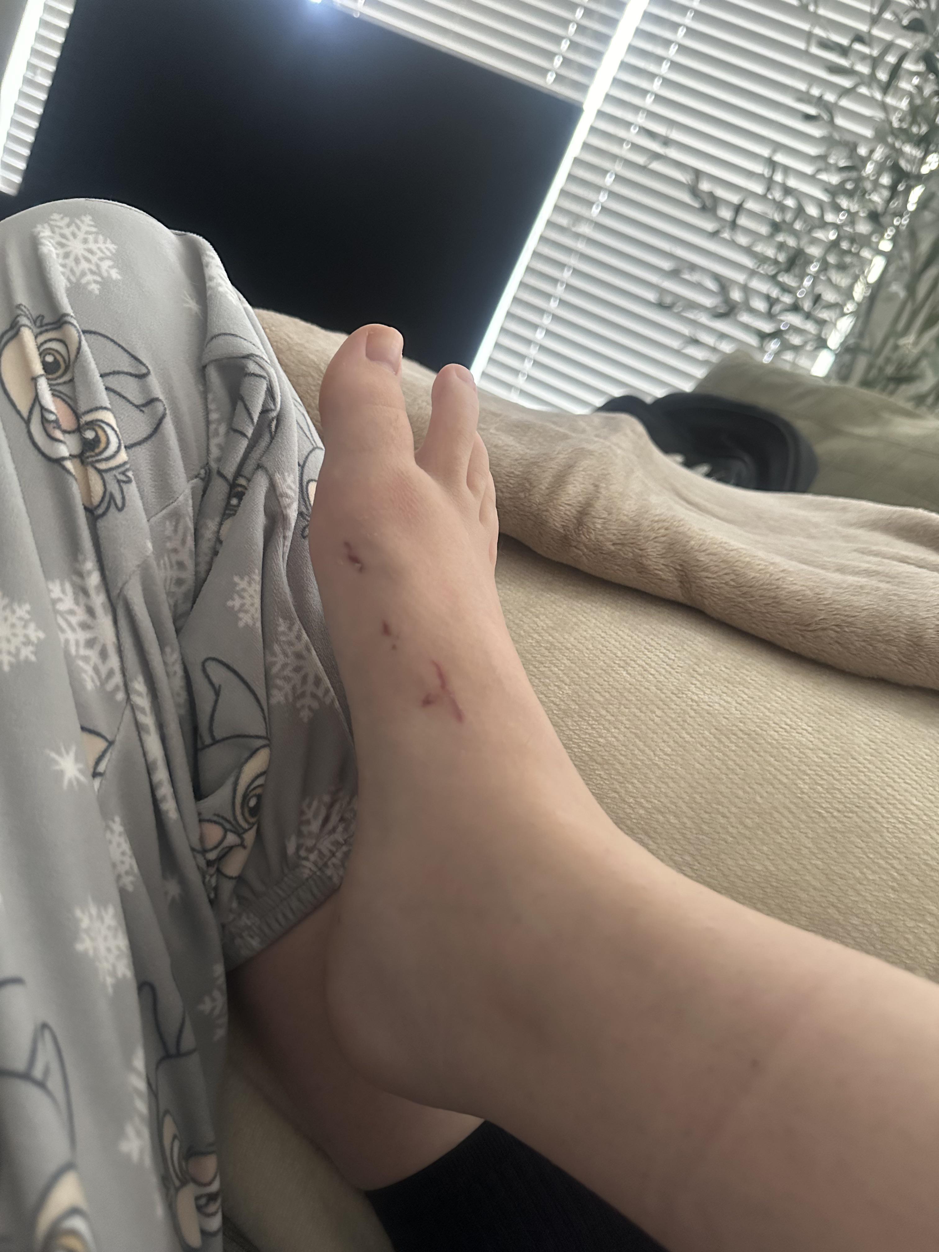 Curar una cicatriz facial reciente : rSkincare_Addiction