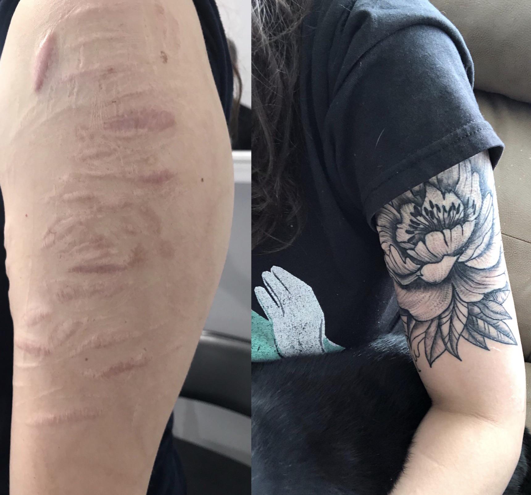 Still Not Shaded At The Top So I Covered That Part And Still Needs Color But Even Without Color It Still Covers My Self Harm Scars Incredibly Well I Feel New And