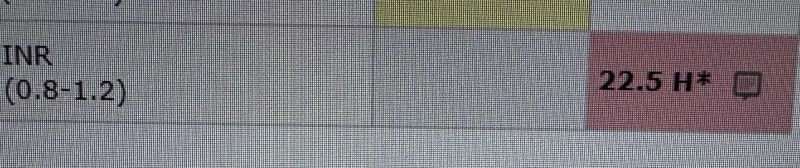 Wowza R Ratm - Minimal Illustrations - Gorgeous Full HD Collection