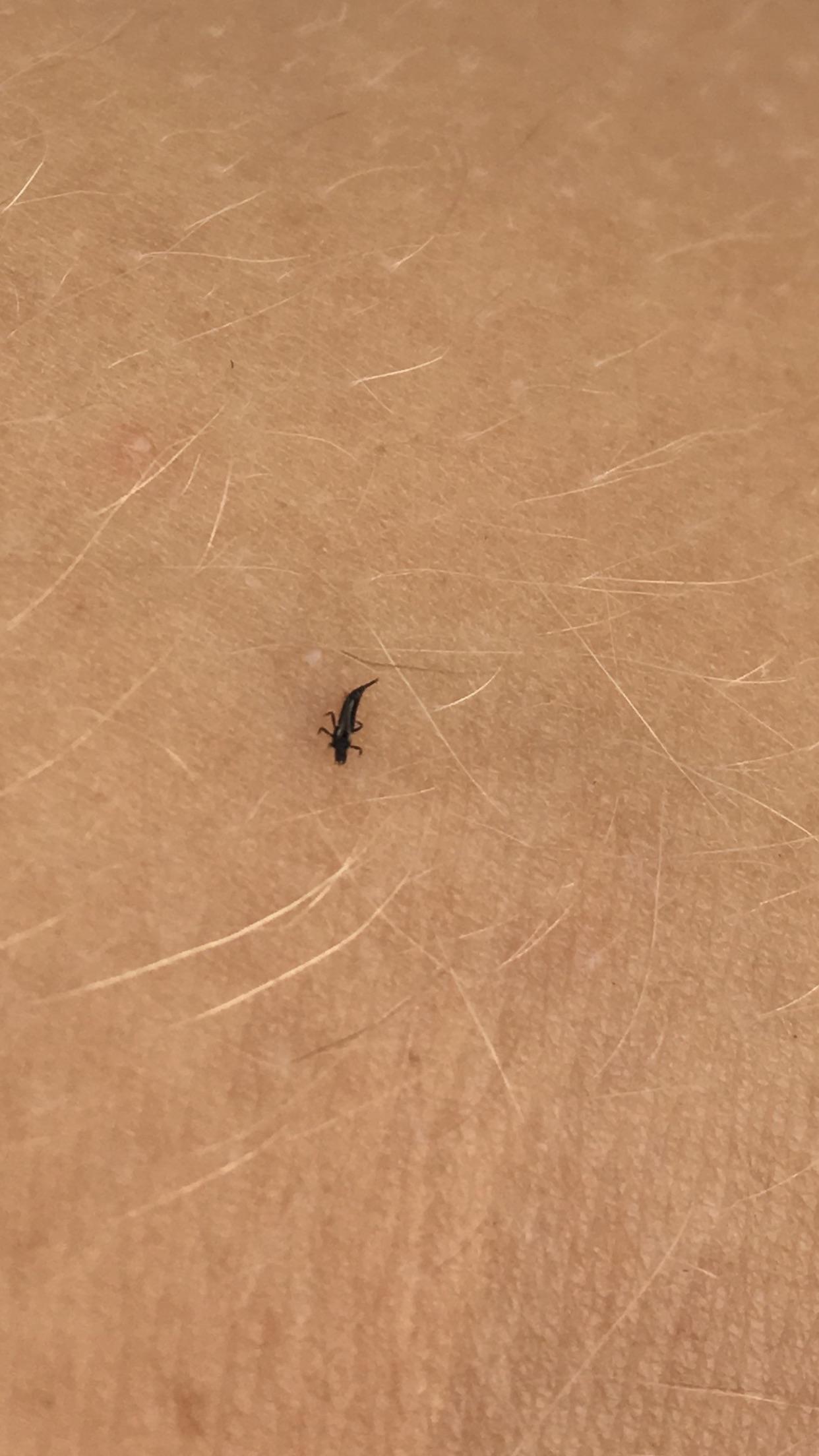 These tiny black biting bugs?