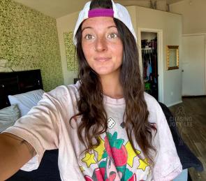 Long hair and freckles every where.