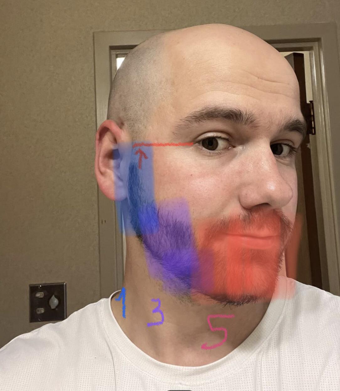 Che ci fate voi pelati barbuti con le basette? Non so che farmene delle mie  : rbald