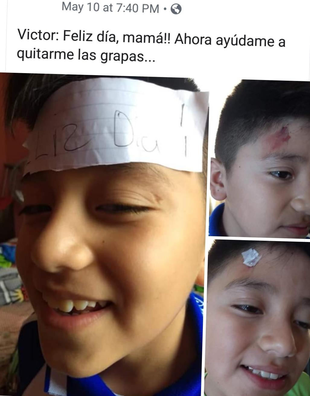 pics Child Staples In Head kid staples himself as a mother s day